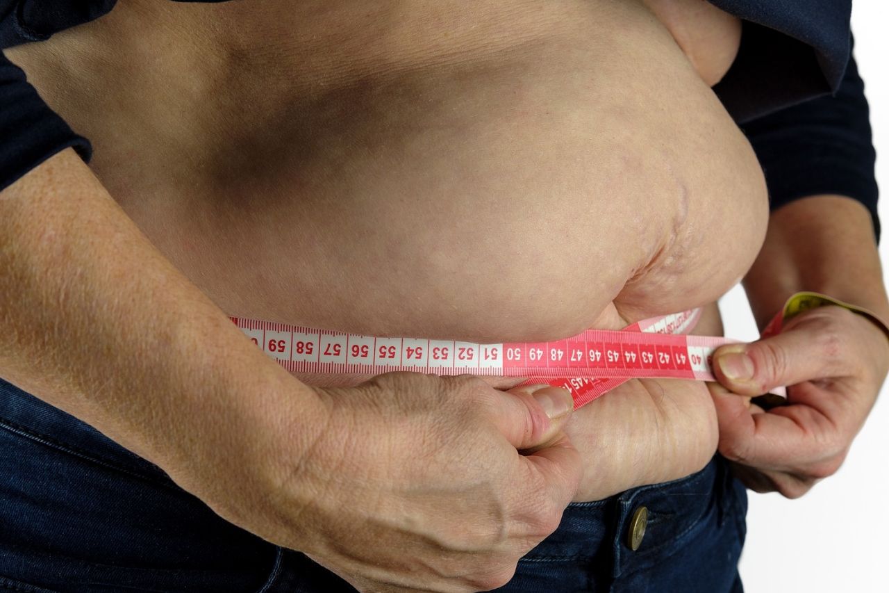 OBESIDADE: COMO EMAGRECER?