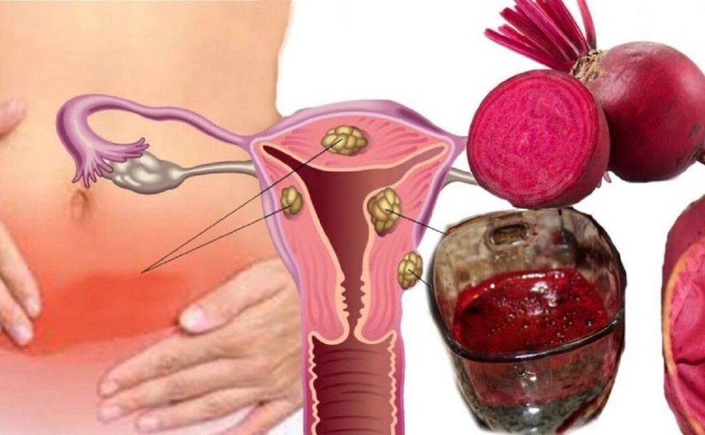 Menstruação abundante  