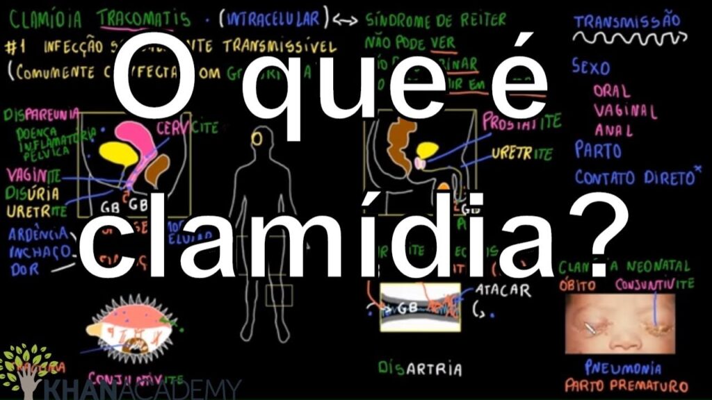 O que é a Clamídia?