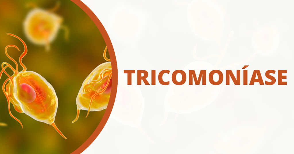 Tricomoníase